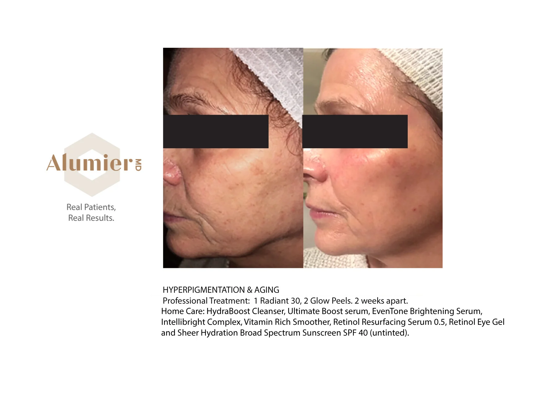 AlumierMD